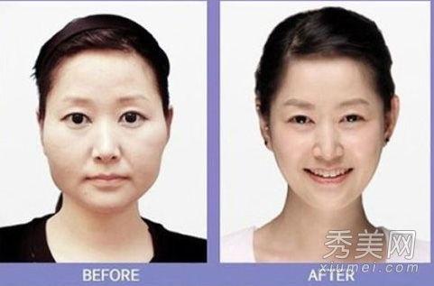 韩国整容手术,美丽背后的秘密与争议